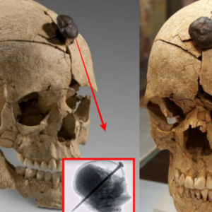 Revealing History’s Mystery: Iron-Nailed Skull of a Young Ancient Warrior