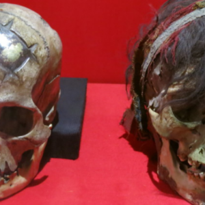 Early Excellence in Cranial Surgery: A Successful Cranioplasty from Peru (400 CE)