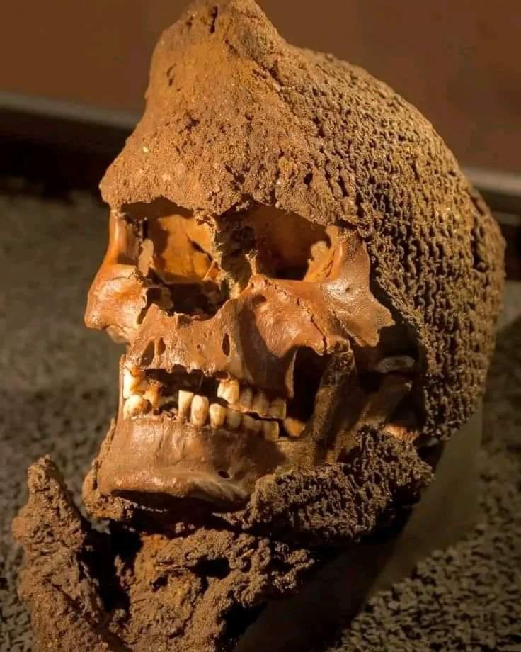 Skull wearing a medieval chainmail from a mᴀss grave on the Island of  Gotland, Sweden. The Battle of Visby (1361) was a violent Medieval battle,  fought between the inhabitants of Gotland and