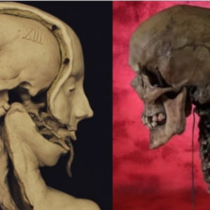 Unraveling the Mystery of the Two-Headed Skull: Examining Archaeological Autopsy Findings for Answers