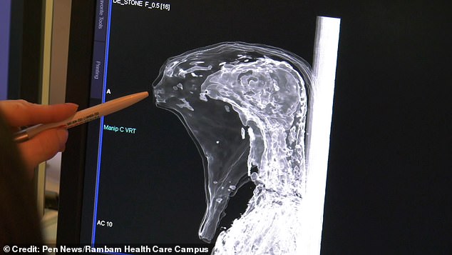 HAIFA, ISRAEL PH๏τo shows a second bird-like mummy. A mysterious child-like mummy has been unmasked as the ancient Egyptian god of the ᴅᴇᴀᴅ after a CT scan revealed the remains aren't human (Credit: Pen News/Rambam Health Care Campus) (Pen News Â£25, Â£15, Â£10 online) (Contact editor@pennews.co.uk/07595759112)