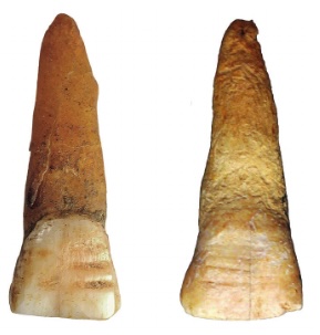 The crescent-shaped grooves were found on all upper incisors