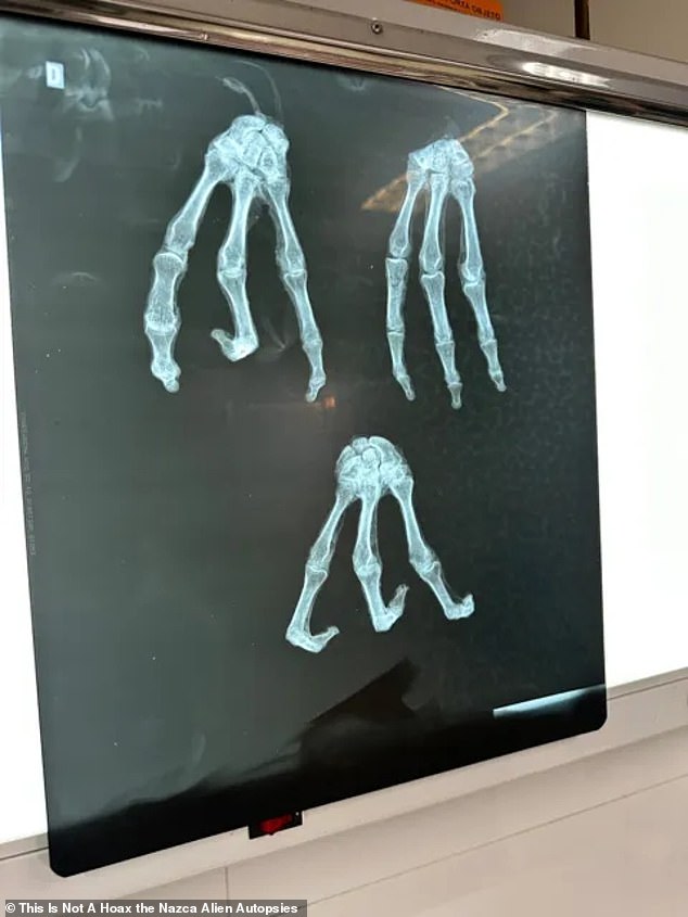 'To see these tridactyl organisms,' forensic odontologist Dr John McDowell told DailyMail.com, 'all of them tridactyl, I have never seen that [...] never a big group like this.' Above, X-rays  conducted on one of the apparent 'aliens' at the behest of Mexican journalist Jaime Maussan