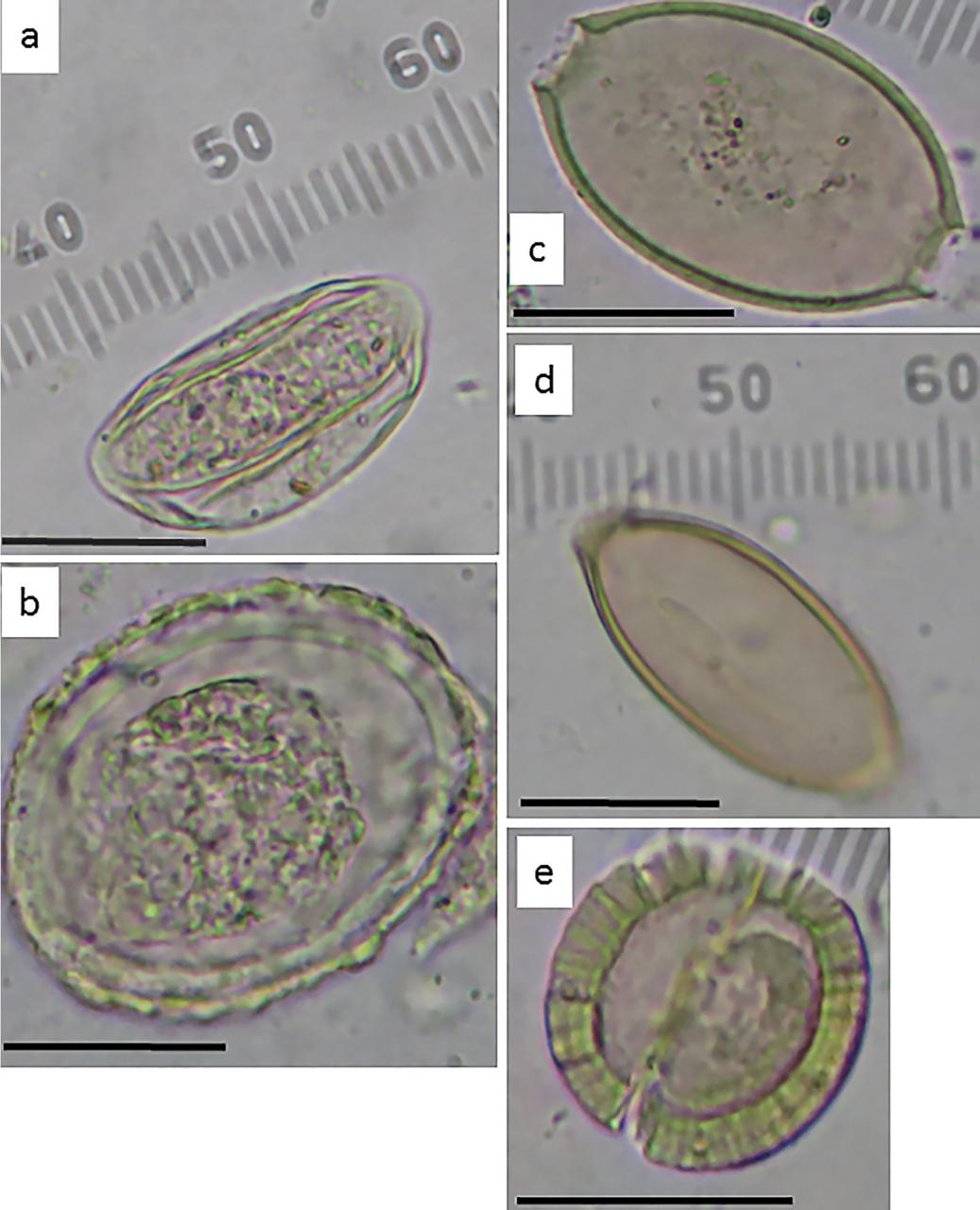 Intestinal paratise eggs recovered from the sediment below the stone toilet in Jerusalem.