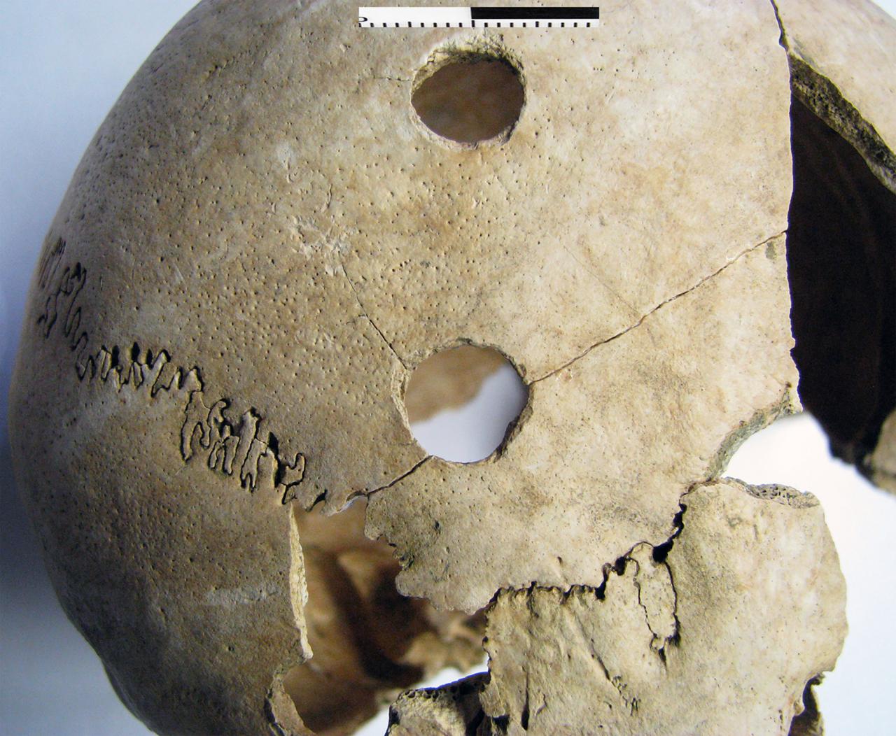 Archaeologists found evidence of traumatic injuries to the back of the skull and some skulls had puncture wounds.