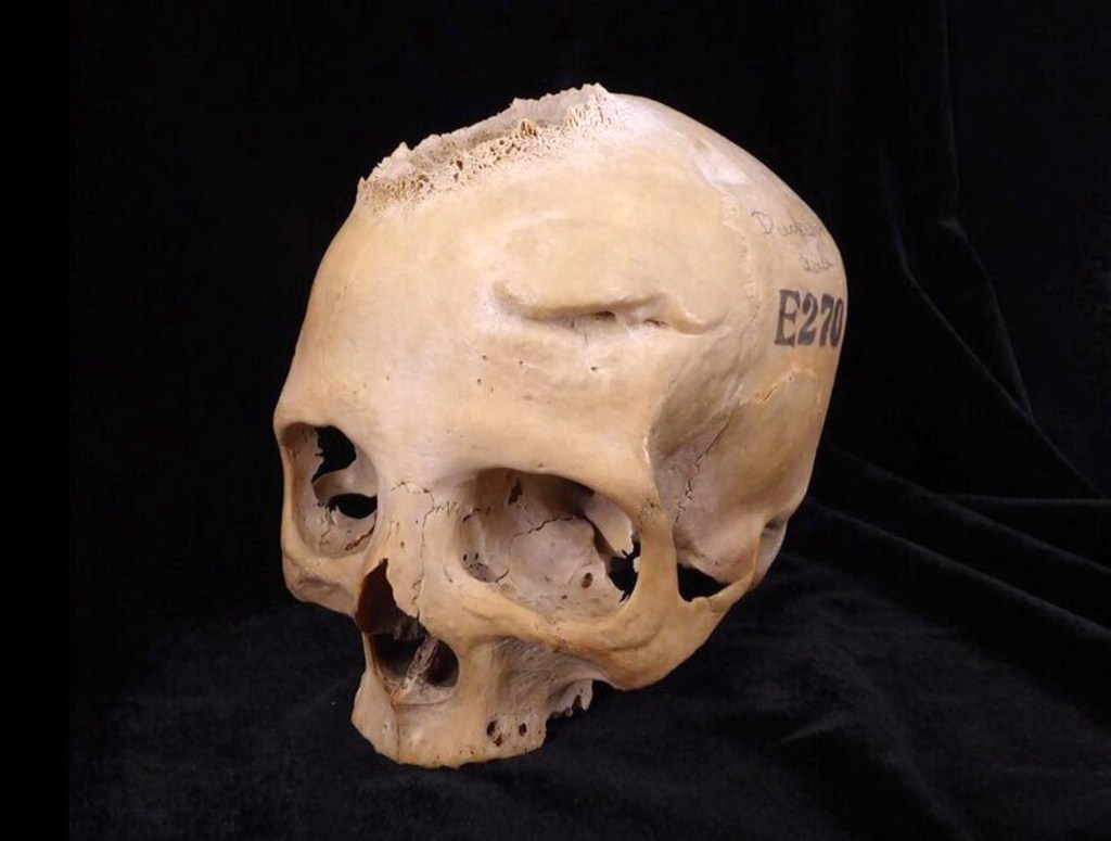 The second skull, from a woman older than 50, is from 663 to 343 BC.