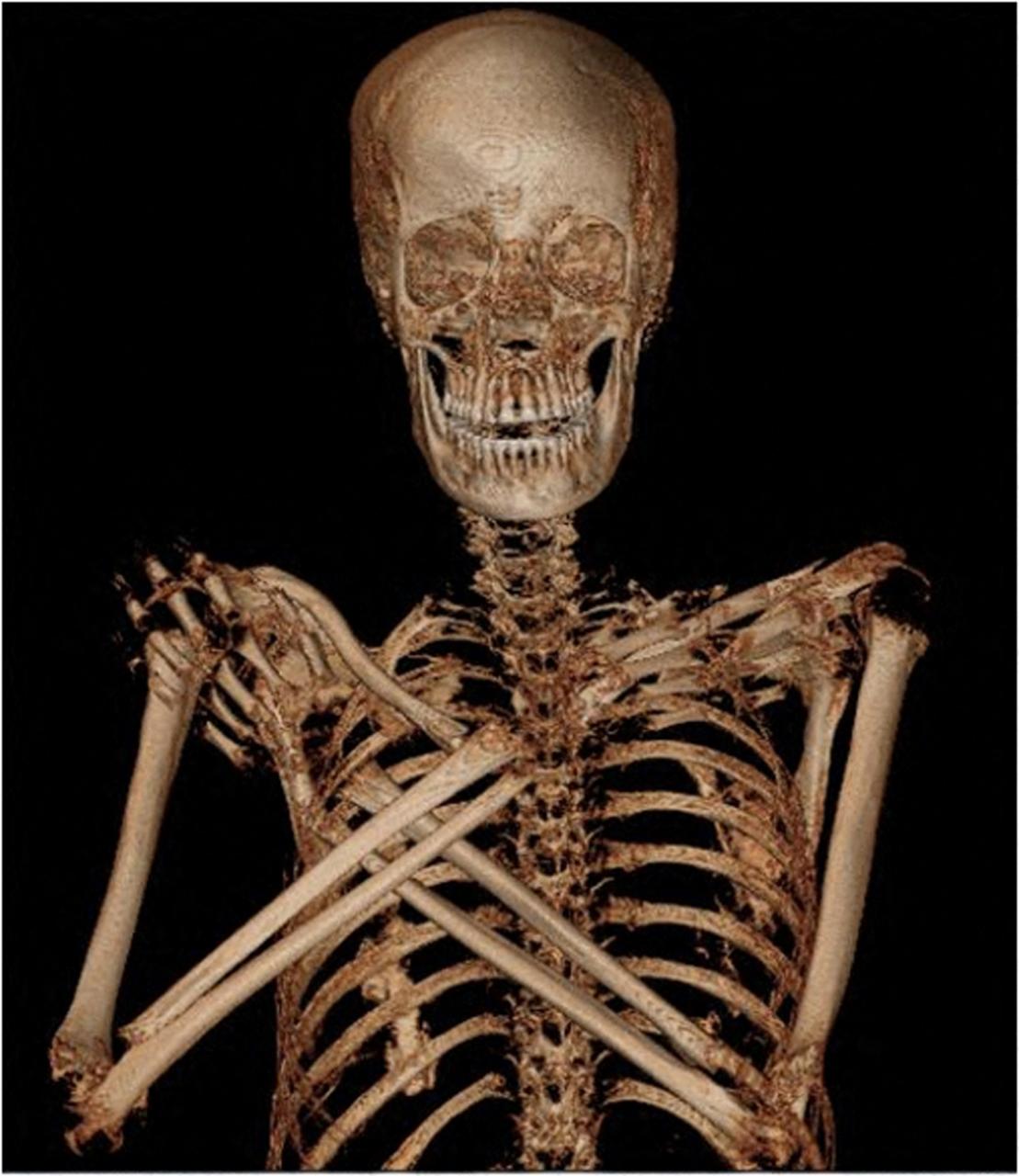 The remains of an ancient Egyptian mummified pregnant woman has been found.