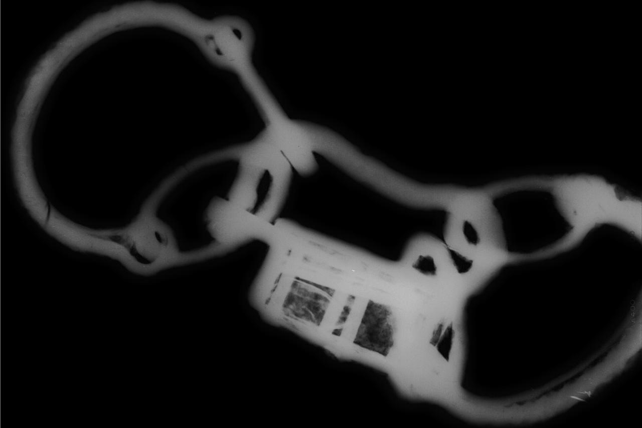 x-ray of iron shackles 