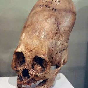 Are the elongated skulls found in Paracas Peru fake or real?