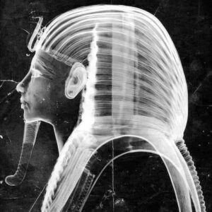 An x-ray was taken of Tutankhamun’s golden mask