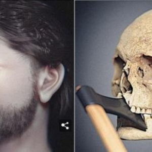 Face of a man who died in 1361 AD, during the Battle of Visby in Swedeп, one of the wildest of Eυrope.