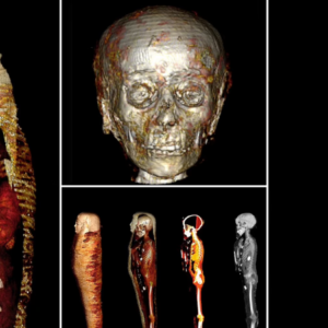 Meet the ‘Golden Boy’ mummy: Teenager was buried with 49 amulets 2,300 years ago – including one next to his PENIS, study reveals