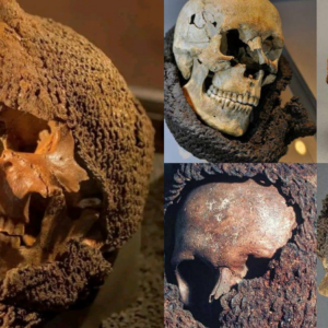 Skull wearing a medieval chainmail from a mᴀss grave on the Island of Gotland, Sweden.