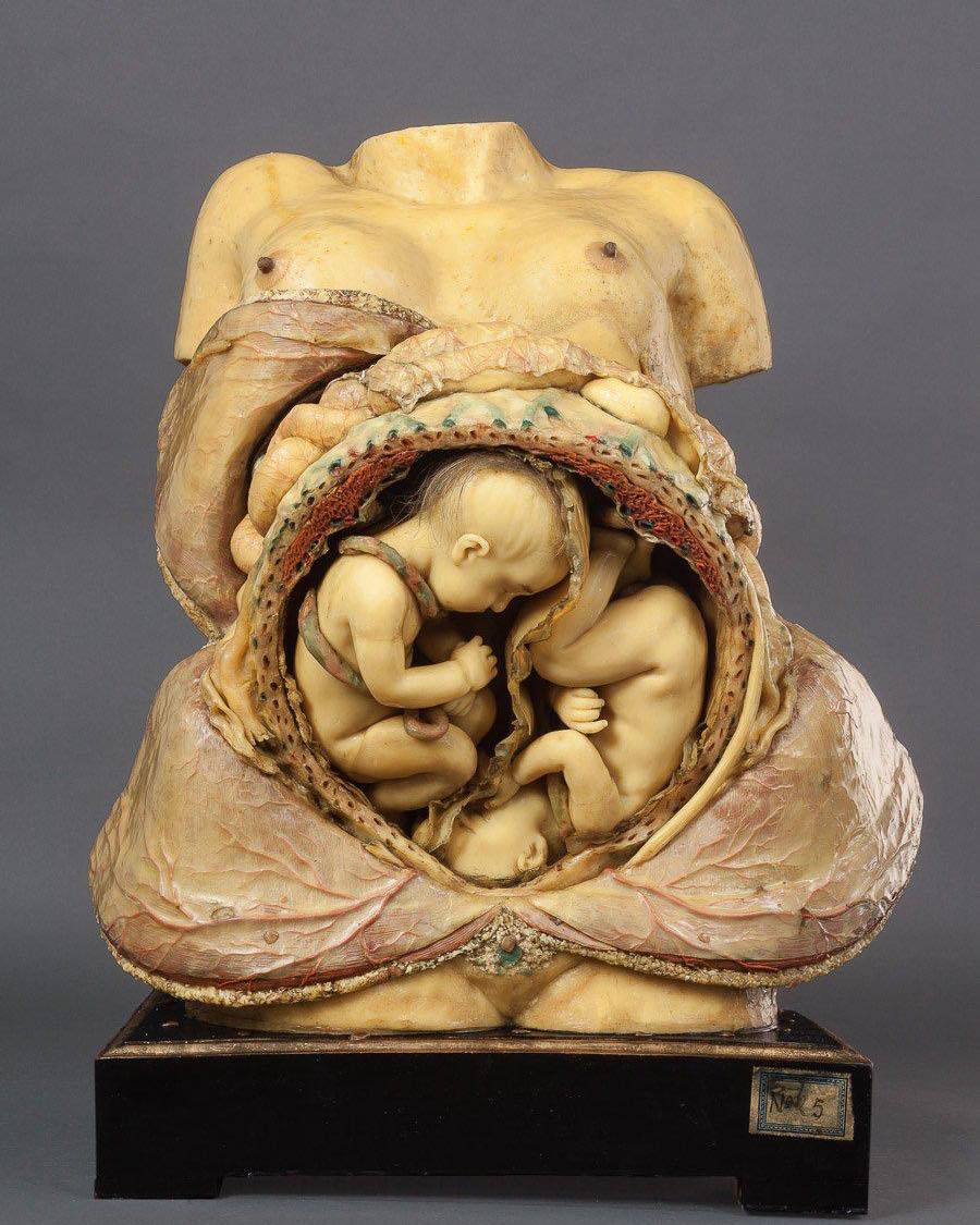 The Javier Puerta Museum: Home to a Remarkably Detailed Wax Anatomical Model