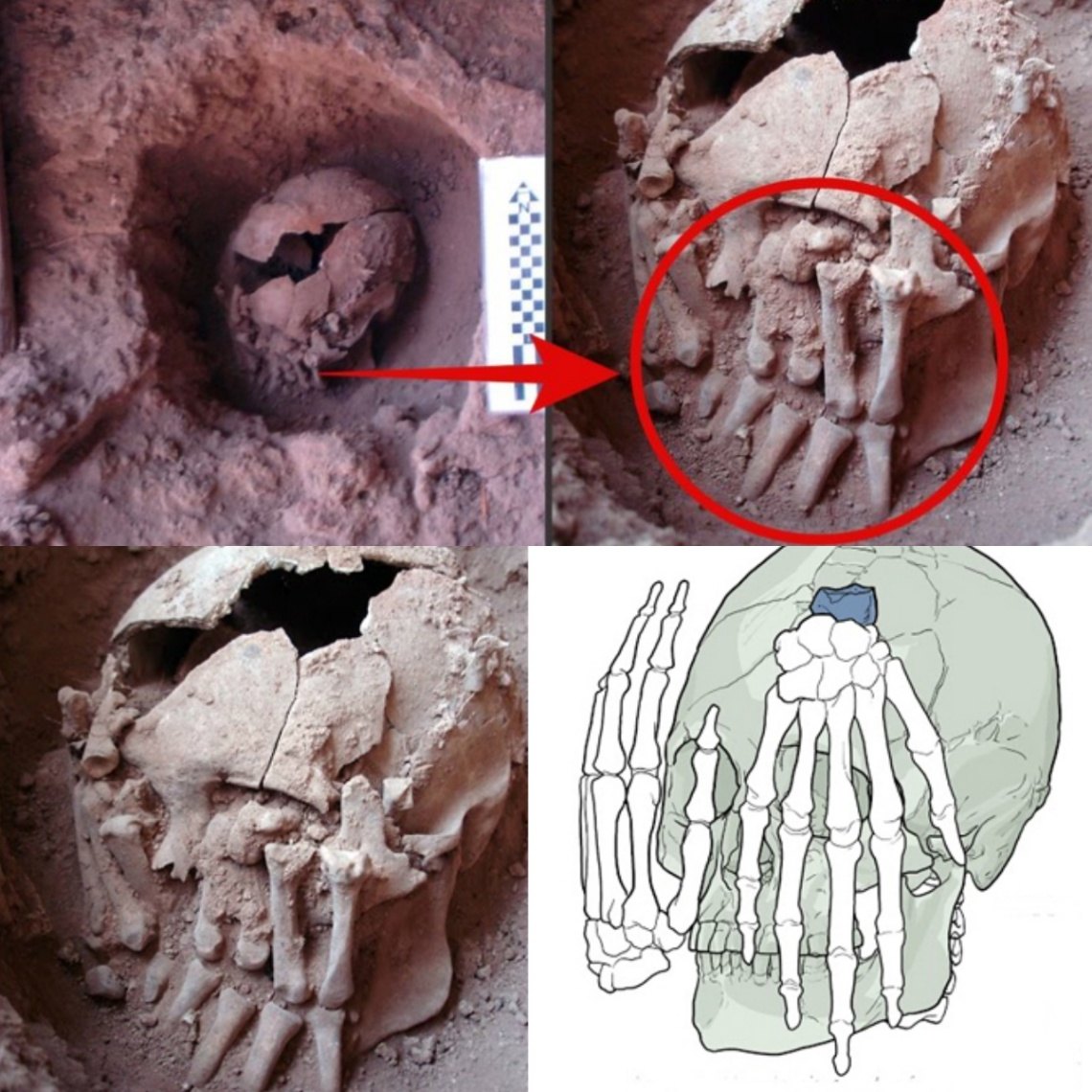 Unveiling Ancient Mysteries: 9,000-Year-Old Head with Amputated Hands Reveals Oldest Ritual Beheading in the Americas