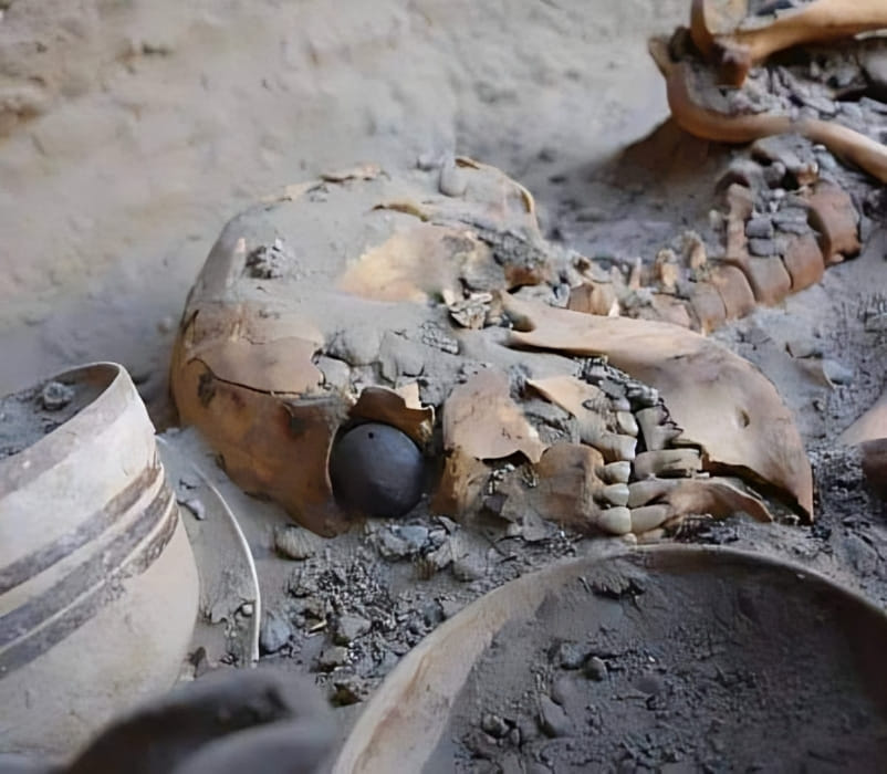 Ancient Innovation: The world’s oldest artificial eye, dating to 2900-2800 BC, discovered in Shahr-e Sukhteh, Iran, showcasing advanced craftsmanship and medical knowledge.