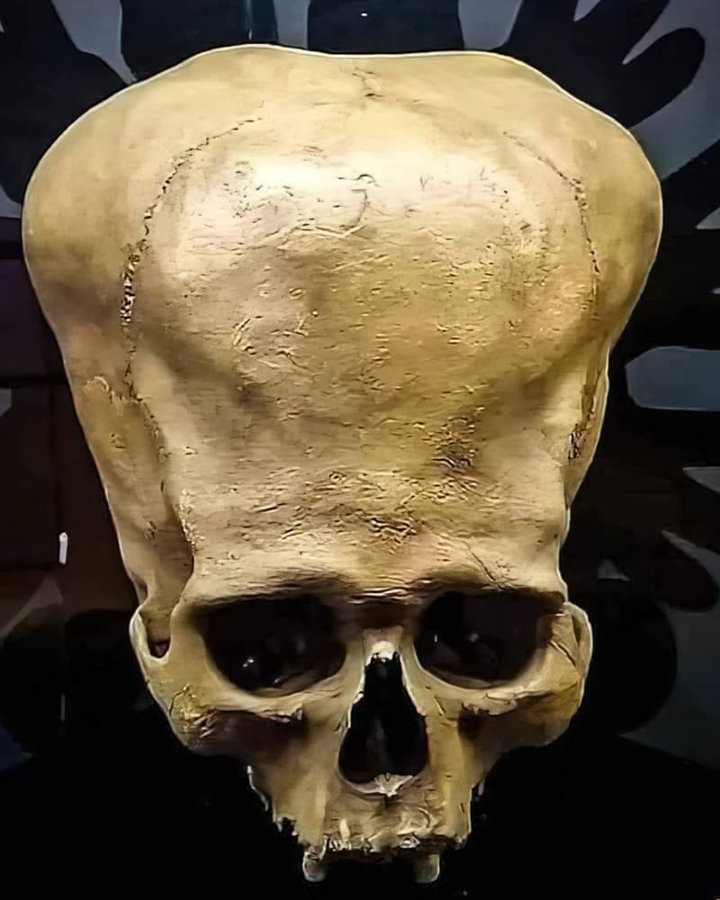 Unveiling the Enigma: 3,000-Year-Old Paracas Skulls Hold Secrets of the Past