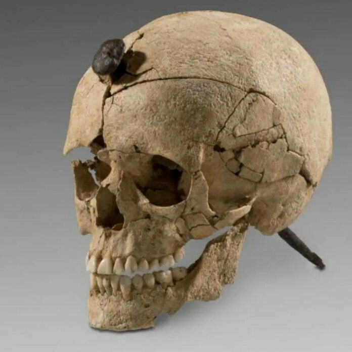 Unveiling Ancient Valor: The Astonishing Iron-Nailed Skull of a Young Warrior Reveals Hidden Tales