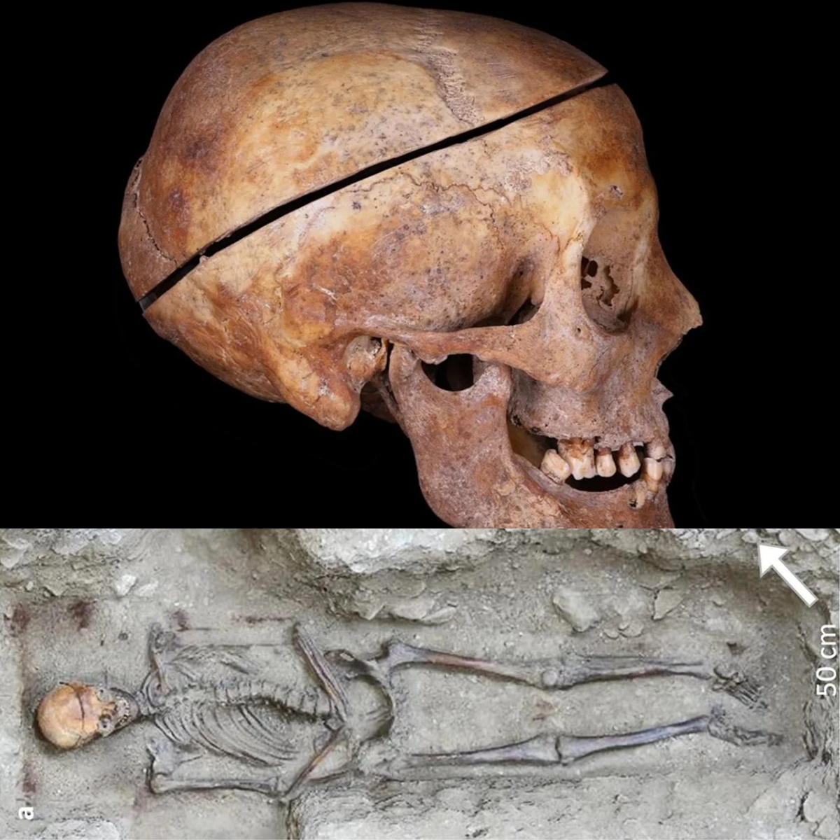 Archaeologists find first evidence of familial embalming in Europe