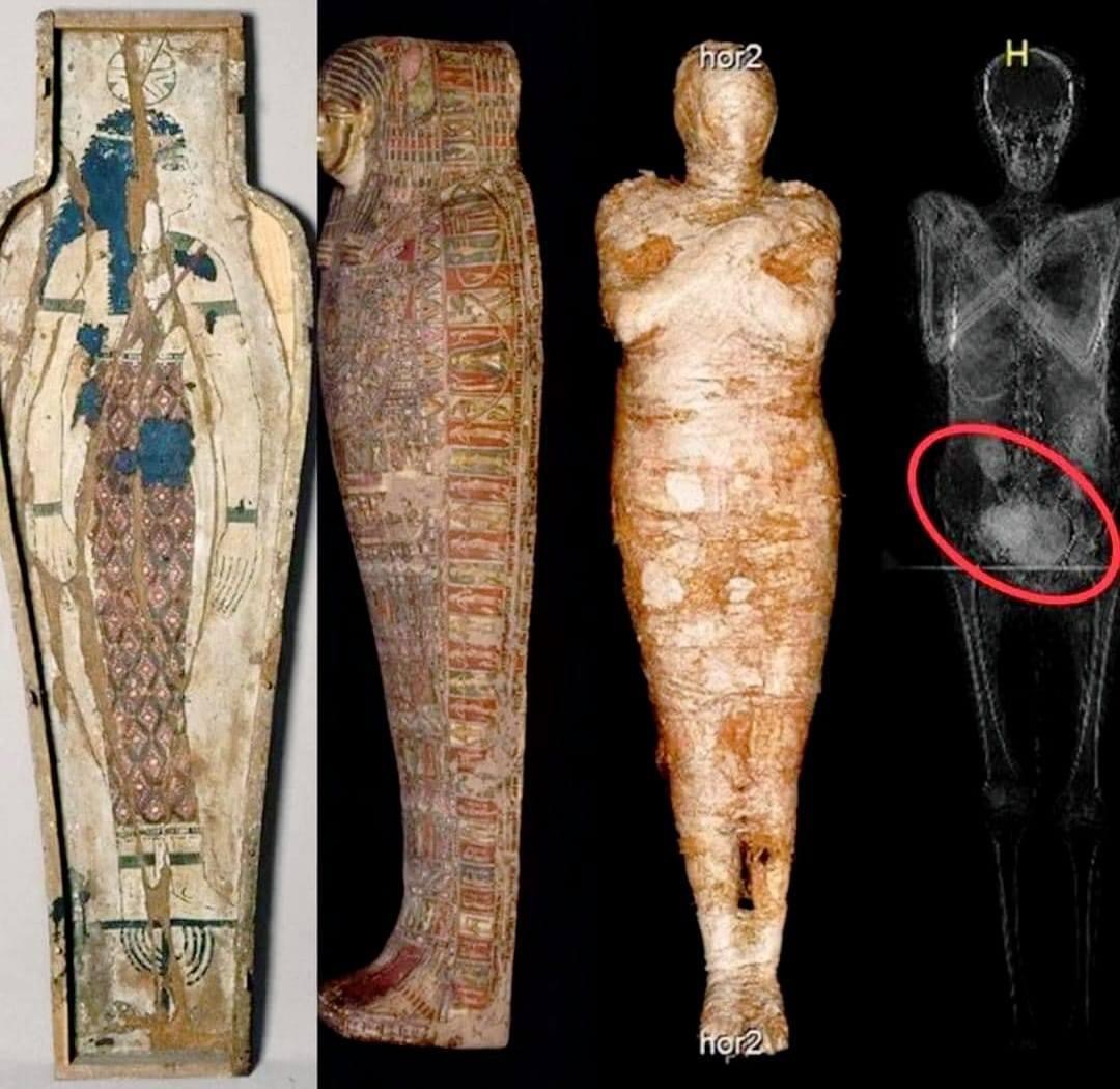 Groundbreaking Discovery: World’s First Pregnant Ancient Egyptian Mummy Found