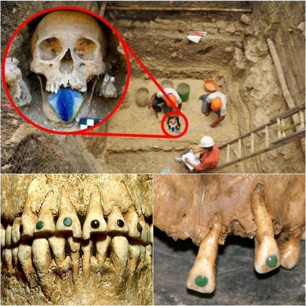 Rare treasure discovered in teeth unearthed in a Mexican cemetery.