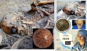 The oldest artificial eye found in Iran, 4,900-5,000 years ago