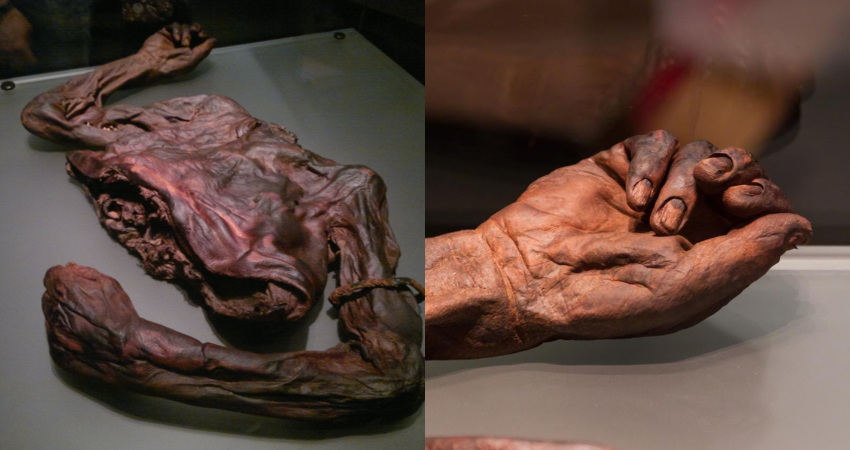 Preserved torso of “Old Croghan Man”, an Iron Age bog body found in Ireland.