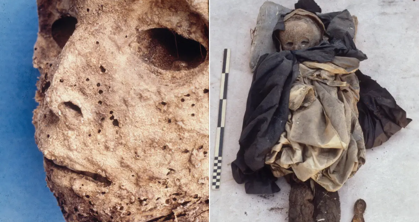 A Mummified Child’s Remains Show Signs of a Modern Scourge